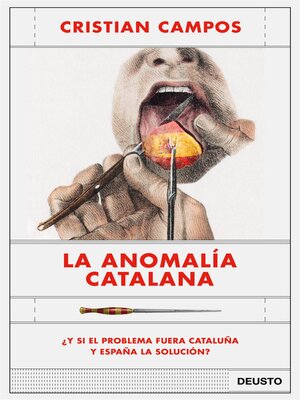cover image of La anomalía catalana